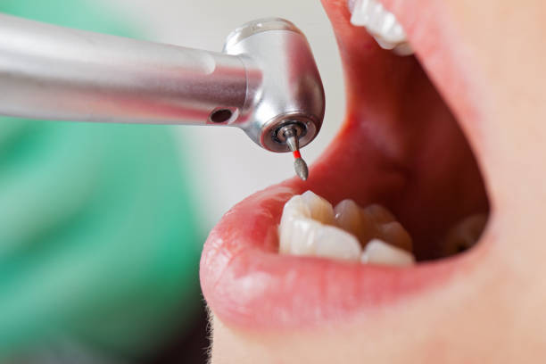 Best Dentist for Tooth Abscess  in Passapatanzy, VA
